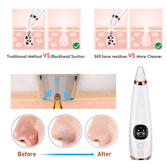 Facial Cleanser Instrument For Deep Cleansing | Removes Dirt and Oil